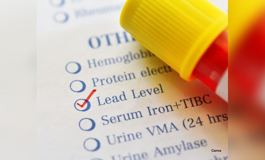 Lead Test Blood Vs Urine